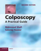 Colposcopy 
