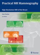 Practical MR Mammography: High-Resolution MRI of the Breast (en Inglés)