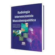Radiología Intervencionista Musculoesquelética