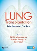 Lung Transplantation: Principles and Practice (en Inglés)
