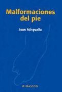 Malformaciones del Pie