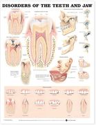 Disorders of the Teeth and jaw Anatomical Chart (en Inglés)