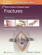 Master Techniques in Orthopaedic Surgery: Fractures (en Inglés)