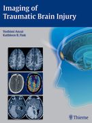 Imaging of Traumatic Brain Injury (en Inglés)
