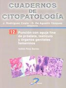 Punción con aguja fina de próstata, testículo y organos genitales femeninos: Cuadernos de citopatología-12