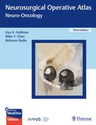 Neurosurgical Operative Atlas: Neuro-Oncology (en Inglés)