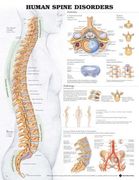 the human spine disorders anatomical