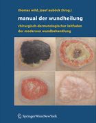 Manual Der Wundheilung: Chirurgisch-Dermatologischer Leitfaden Der Modernen Wundbehandlung (en Alemán)