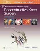 Master Techniques in Orthopaedic Surgery: Reconstructive Knee Surgery (en Inglés)