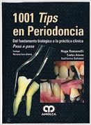 1001 Tips en Periodoncia