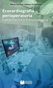 Ecocardiografia perioperatoria, transtoracica y transesofagica