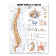 human spine disorders anatomical chart
