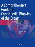 A Comprehensive Guide to Core Needle Biopsies of the Breast (en Inglés)
