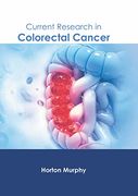 Current Research in Colorectal Cancer (en Inglés)