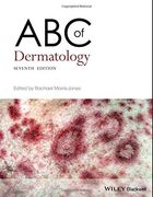 Abc of Dermatology (Abc Series) 