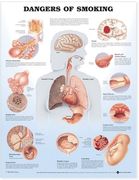 Dangers of Smoking Anatomical Chart (en Inglés)