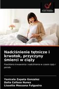 Nadciśnienie tętnicze i krwotok, przyczyny śmierci w ciąży (in Polaco)