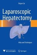 Laparoscopic Hepatectomy: Atlas and Techniques