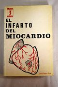 Infarto del Miocardio