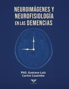 Neuroimágenes y neurofisiología en las demencias