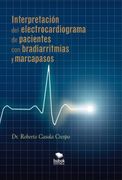 Interpretación del electrocardiograma de pacientes con bradiarritmias y marcapasos