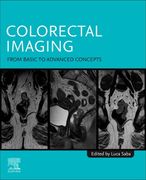 Colorectal Imaging: From Basic to Advanced Concepts (en Inglés)