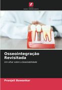 Osseointegração Revisitada: Um Olhar Sobre a Bioestabilidade (en Portugués)