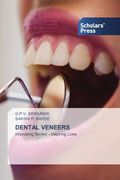 Dental Veneers (en Inglés)