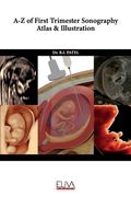 A-z of First Trimester Sonography Atlas & Illustration (en Inglés)