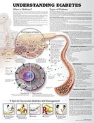 Understanding Diabetes - Tabla Anatómica 