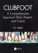 Clubfoot: A Comprehensive Approach (Past, Present, and Future) (en Inglés)