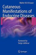 cutaneous manifestations of endocrine diseases (en Inglés)