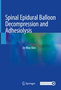 Spinal Epidural Balloon Decompression and Adhesiolysis (en Inglés)
