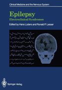 Epilepsy: Electroclinical Syndromes (en Inglés)