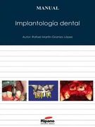 Manual Implantologia Dental