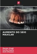 Aumento do Seio Maxilar