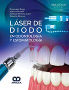 Láser de diodo en odontología y estomatología