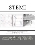 Stemi: 3-Minute Diagnosis, 90-Minute Reperfusion: Saving Time, Saves Lives (en Inglés)