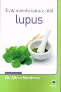 Tratamiento Natural del Lupus (in Spanish)