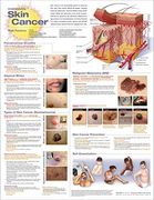 Understanding Skin Cancer Anatomical Chart (en Inglés)