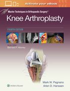 Master Techniques in Orthopedic Surgery: Knee Arthroplasty (en Inglés)