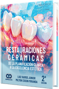 Restauraciones cerámicas. De la planificación clínica a la excelencia estética. 2ª edicion. Incluye e-book