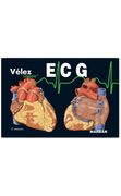 Ecg: Pautas de Electrocardiografía - Velez - Marban