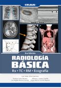 Radiología Básica Rx Tc Rm Ecografía (in Spanish)