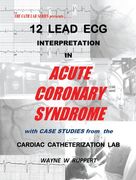 12 lead ecg interpretation in acute coronary syndrome with case studies from the cardiac catheterization lab (en Inglés)