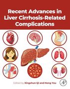 Recent Advances in Liver Cirrhosis Related Complications (en Inglés)
