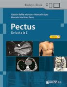 Pectus De la A a la Z (in Spanish)