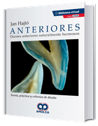 Anteriores. Dientes Anteriores Naturalmente Hermosos. Teoría, Práctica y Criterios de Diseño. Incluye e-book