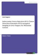 Indocyanine Green Injection (ICG). Tumor Detection Potential of ICG-navigated Imaging in Liver Surgery for Metastatic Lesions (en Inglés)