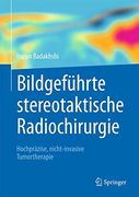 Bildgeführte Stereotaktische Radiochirurgie. Hochpräzise, Nicht-Invasive Tumortherapie. (en Alemán)